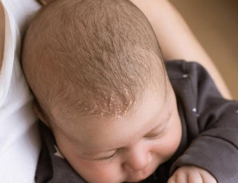 Brosse cheveux bébé croute de lait