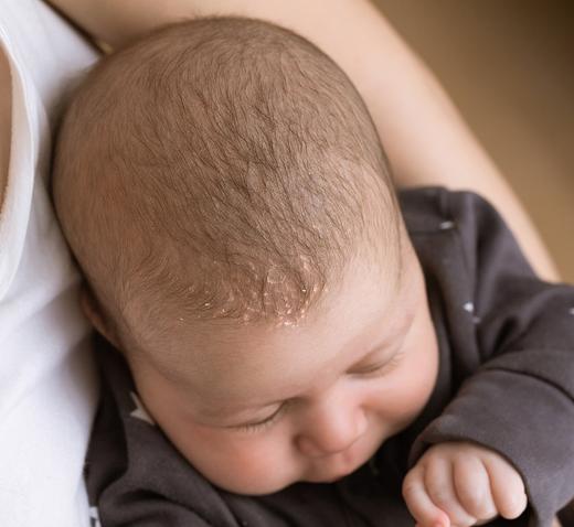 Shampooing bébé certifié bio 2 en 1 - croûtes de lait